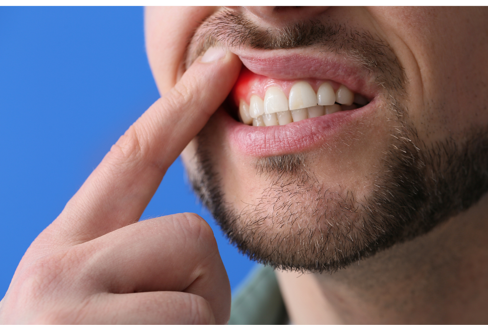 Diş Eti Operasyonları